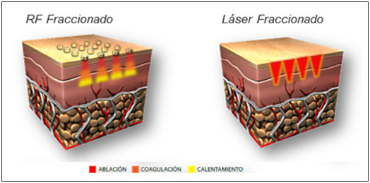 Img como funciona